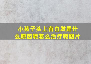 小孩子头上有白发是什么原因呢怎么治疗呢图片