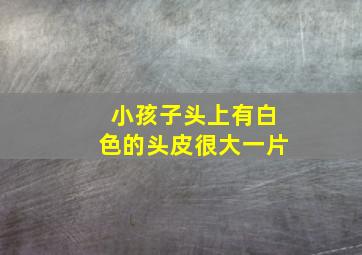 小孩子头上有白色的头皮很大一片