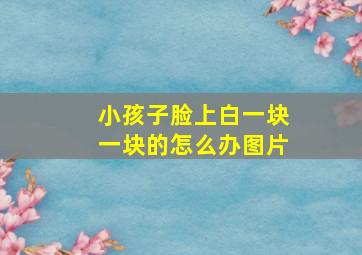 小孩子脸上白一块一块的怎么办图片