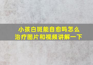 小孩白斑能自愈吗怎么治疗图片和视频讲解一下