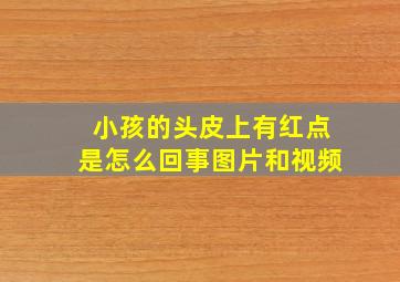 小孩的头皮上有红点是怎么回事图片和视频