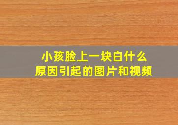 小孩脸上一块白什么原因引起的图片和视频