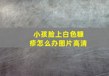 小孩脸上白色糠疹怎么办图片高清