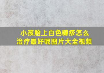 小孩脸上白色糠疹怎么治疗最好呢图片大全视频