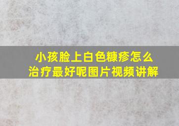 小孩脸上白色糠疹怎么治疗最好呢图片视频讲解