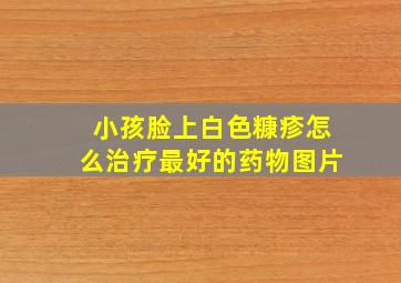 小孩脸上白色糠疹怎么治疗最好的药物图片