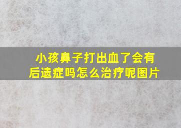 小孩鼻子打出血了会有后遗症吗怎么治疗呢图片