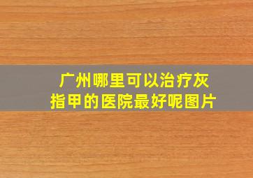 广州哪里可以治疗灰指甲的医院最好呢图片