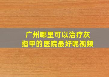 广州哪里可以治疗灰指甲的医院最好呢视频