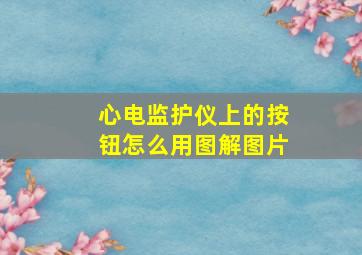 心电监护仪上的按钮怎么用图解图片