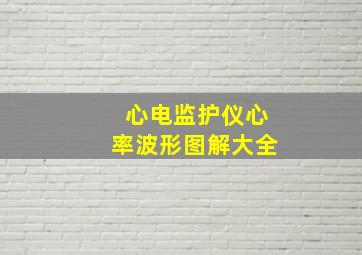 心电监护仪心率波形图解大全