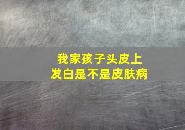 我家孩子头皮上发白是不是皮肤病