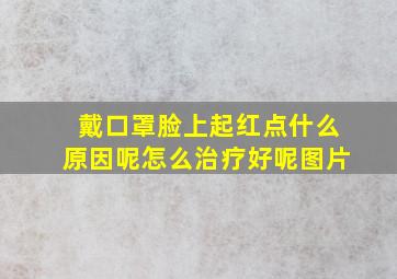 戴口罩脸上起红点什么原因呢怎么治疗好呢图片