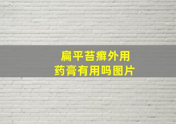 扁平苔癣外用药膏有用吗图片