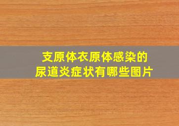 支原体衣原体感染的尿道炎症状有哪些图片