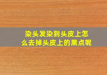 染头发染到头皮上怎么去掉头皮上的黑点呢