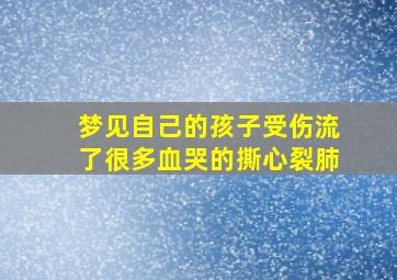 梦见自己的孩子受伤流了很多血哭的撕心裂肺