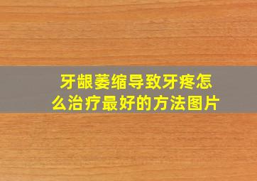 牙龈萎缩导致牙疼怎么治疗最好的方法图片