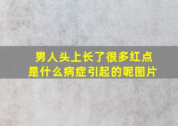 男人头上长了很多红点是什么病症引起的呢图片