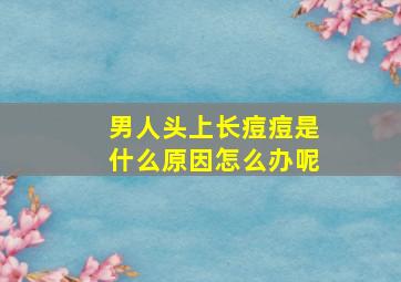 男人头上长痘痘是什么原因怎么办呢