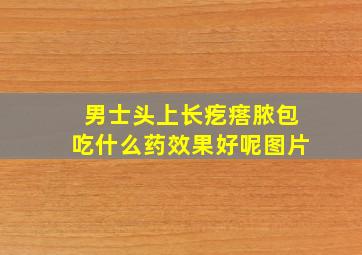 男士头上长疙瘩脓包吃什么药效果好呢图片