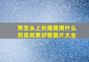 男生头上长痘痘用什么药膏效果好呢图片大全