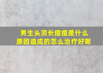 男生头顶长痘痘是什么原因造成的怎么治疗好呢