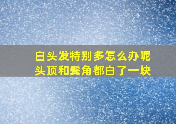 白头发特别多怎么办呢头顶和鬓角都白了一块