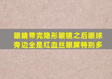 眼睛带完隐形眼镜之后眼球旁边全是红血丝眼屎特别多