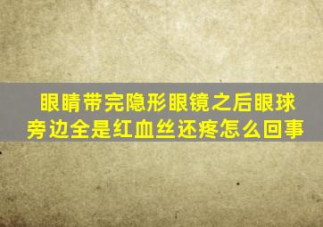 眼睛带完隐形眼镜之后眼球旁边全是红血丝还疼怎么回事