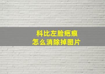 科比左脸疤痕怎么消除掉图片