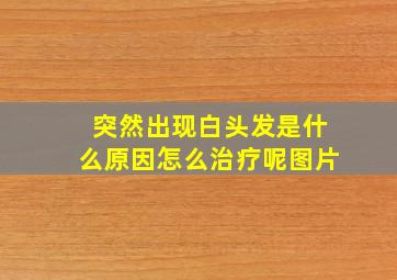 突然出现白头发是什么原因怎么治疗呢图片