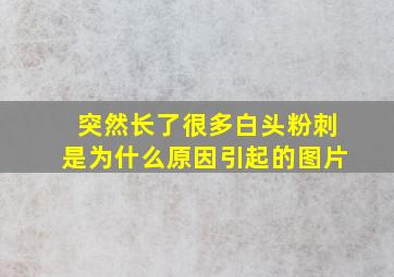 突然长了很多白头粉刺是为什么原因引起的图片