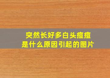 突然长好多白头痘痘是什么原因引起的图片