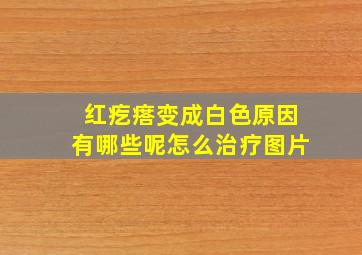 红疙瘩变成白色原因有哪些呢怎么治疗图片