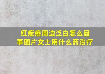 红疙瘩周边泛白怎么回事图片女士用什么药治疗