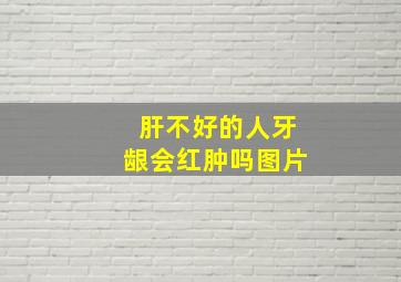 肝不好的人牙龈会红肿吗图片