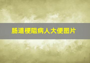 肠道梗阻病人大便图片