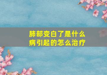 肺部变白了是什么病引起的怎么治疗