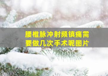 腰椎脉冲射频镇痛需要做几次手术呢图片