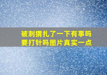 被刺猬扎了一下有事吗要打针吗图片真实一点