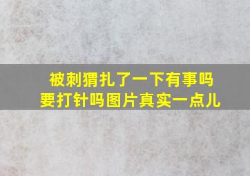 被刺猬扎了一下有事吗要打针吗图片真实一点儿