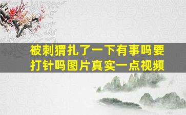 被刺猬扎了一下有事吗要打针吗图片真实一点视频