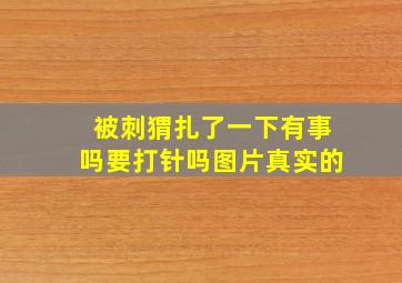 被刺猬扎了一下有事吗要打针吗图片真实的