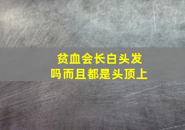 贫血会长白头发吗而且都是头顶上