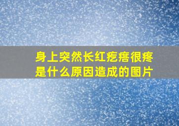 身上突然长红疙瘩很疼是什么原因造成的图片