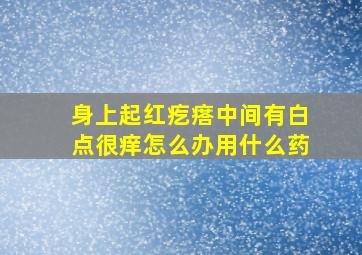 身上起红疙瘩中间有白点很痒怎么办用什么药