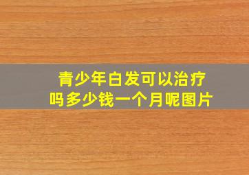 青少年白发可以治疗吗多少钱一个月呢图片