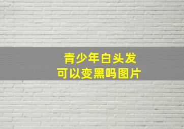 青少年白头发可以变黑吗图片