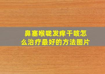 鼻塞喉咙发痒干咳怎么治疗最好的方法图片